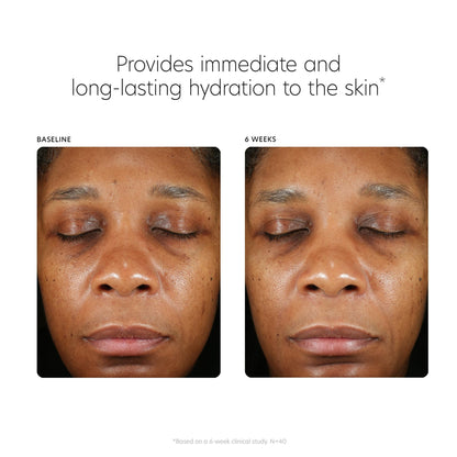 PCA SKIN Hyaluronic Acid Boosting Face Serum, Hyaluronic Acid Serum for Face Made with Niacinamide and Ceramides, Helps Reduce Fine Lines and Wrinkles - dailyvitalstore