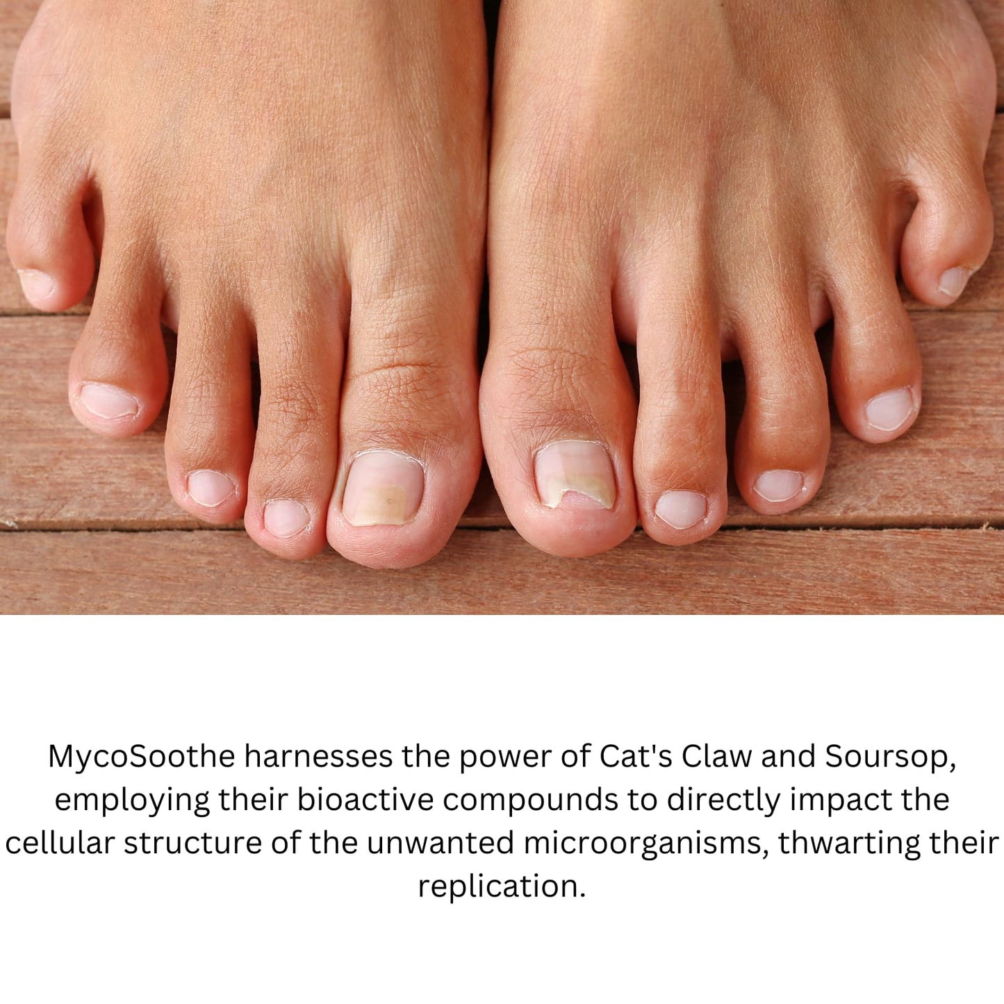 Phytage Labs MycoSoothe Advanced Hair, Skin, Nail & Immunity Support Formula - 60 Capsules - dailyvitalstore