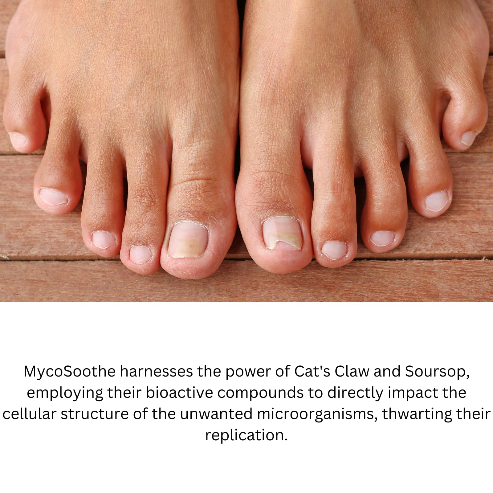 Phytage Labs MycoSoothe Advanced Hair, Skin, Nail & Immunity Support Formula - 60 Capsules - dailyvitalstore