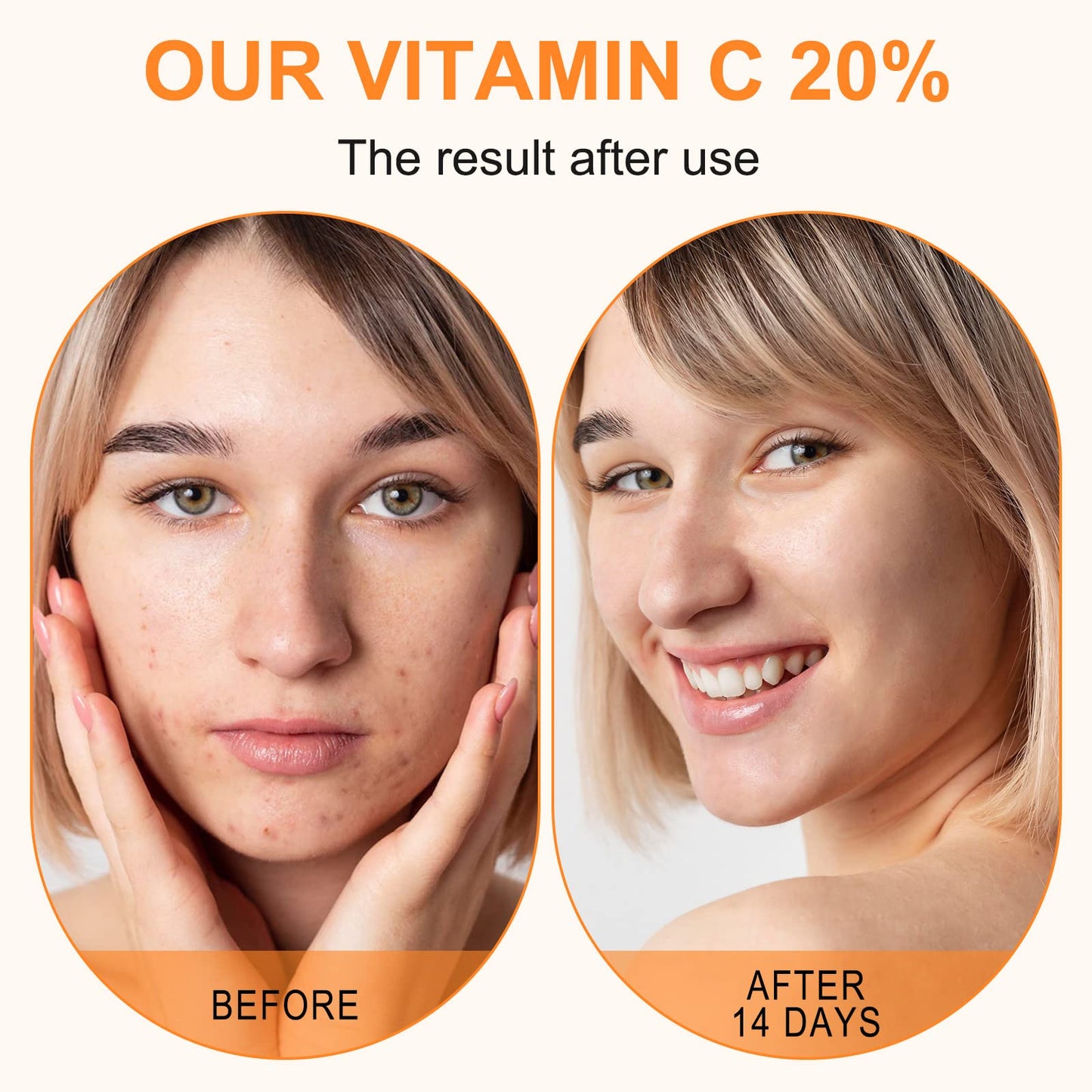 Premium 20% Vitamin C Serum For Face with Hyaluronic Acid, Retinol & Amino Acids - Boost Skin Collagen,Hydrate & Plump Skin, - dailyvitalstore