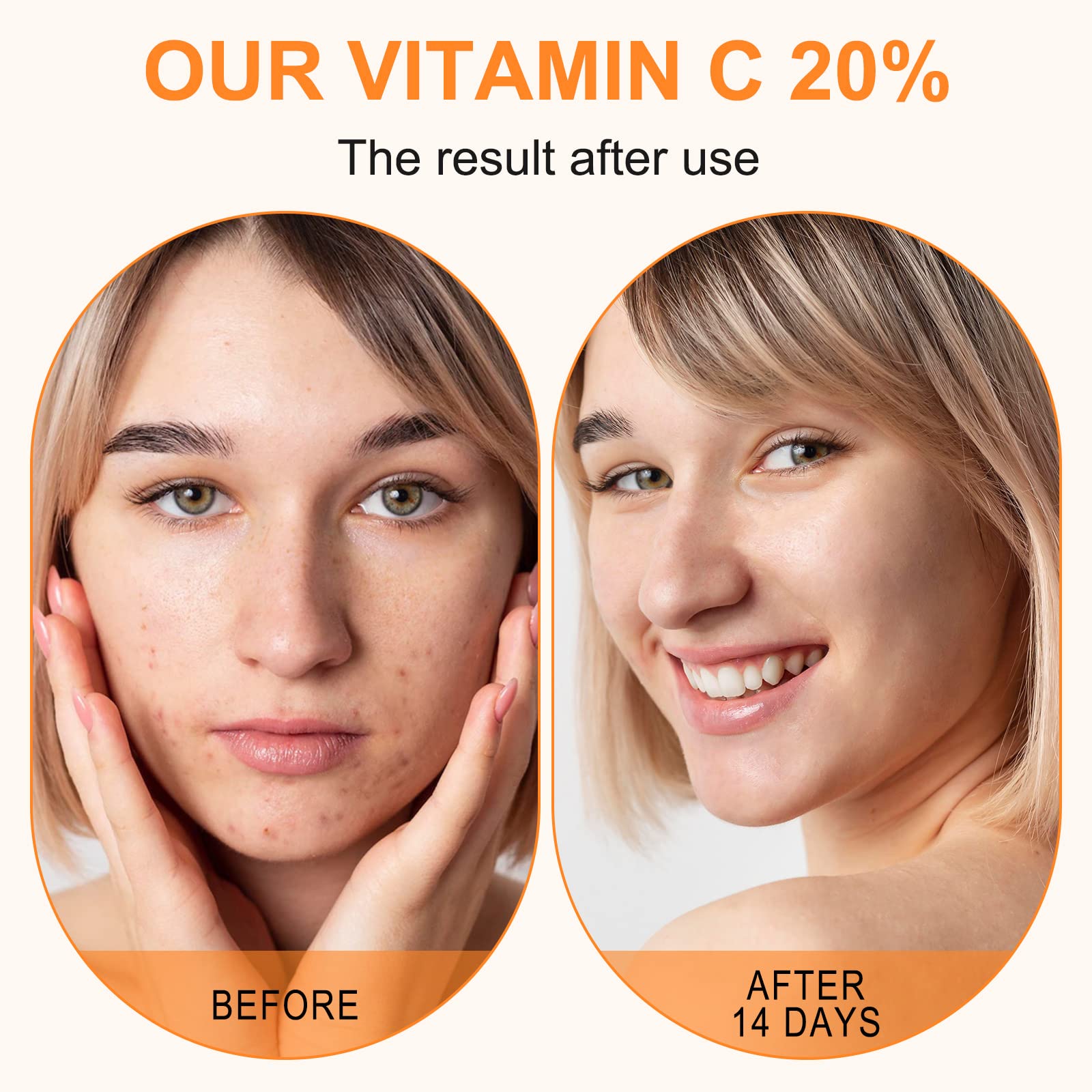Premium 20% Vitamin C Serum For Face with Hyaluronic Acid, Retinol & Amino Acids - Boost Skin Collagen,Hydrate & Plump Skin, - dailyvitalstore