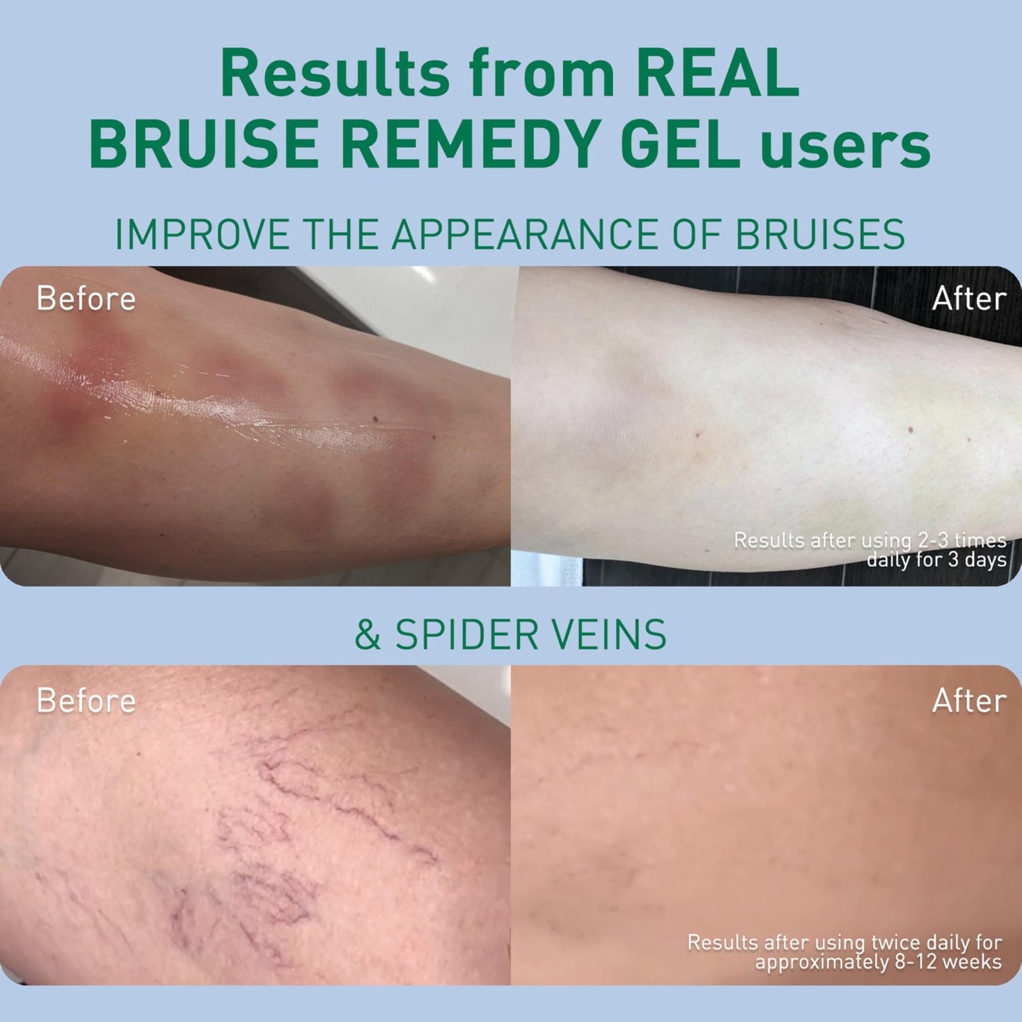 PROcure Arnica & MSM Bruise Remedy Gel – Paraben-Free, Unscented Arnica Montana Gel for Bruising, Spider Veins & Skin Discoloration – 2 Pack - dailyvitalstore