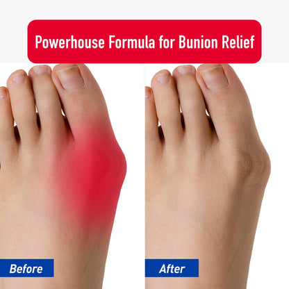 PROFOOT Bunion Relief Rub, White - dailyvitalstore