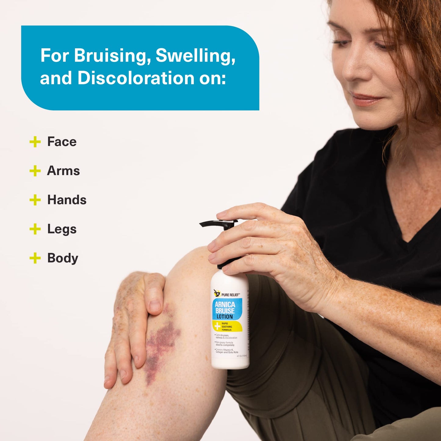 Pure Relief Arnica Bruise Relief Lotion for Bruising, Swelling, & Discoloration On Skin, Natural Skin Care Arnica Bruise Homeopathic Topical Bruise Cream W/Aloe Vera & Collagen, 4 Fl Oz (Pack of 3) - dailyvitalstore