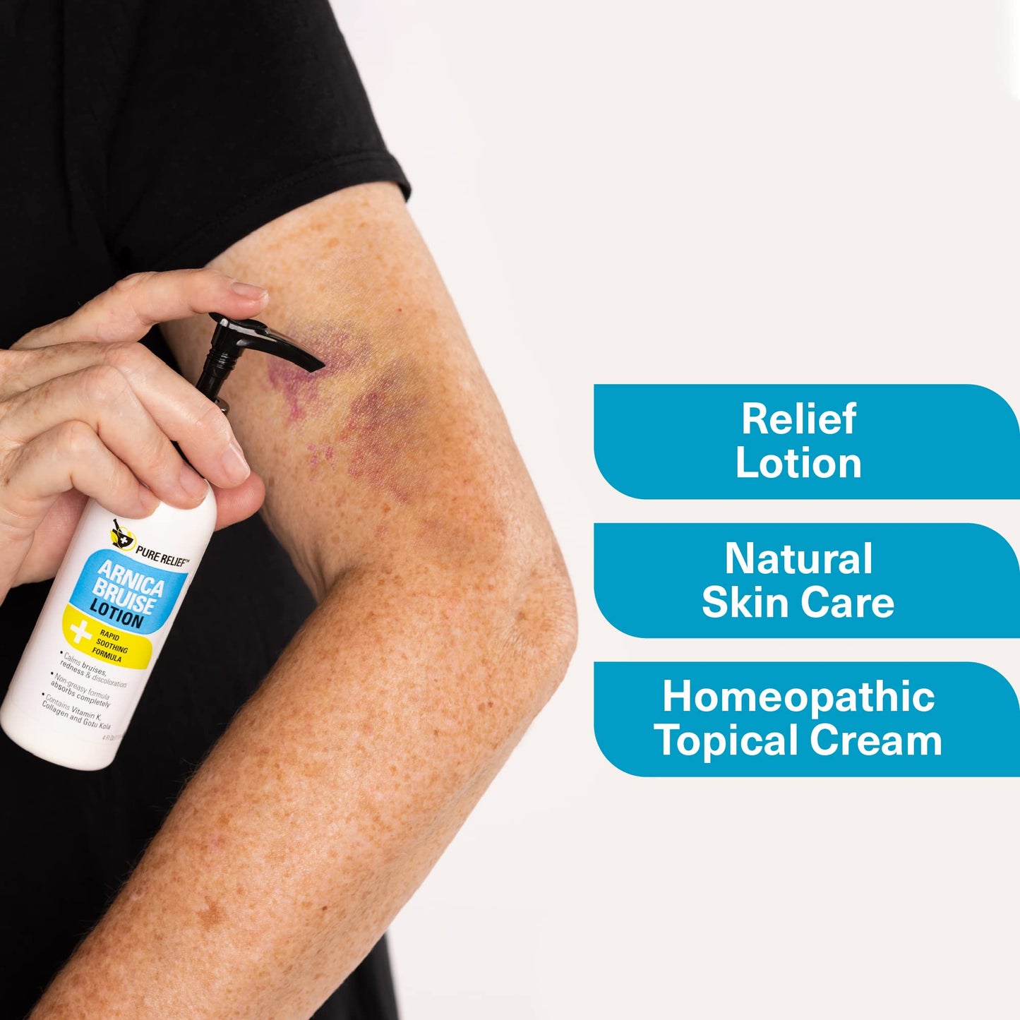 Pure Relief Arnica Bruise Relief Lotion for Bruising, Swelling, & Discoloration On Skin, Natural Skin Care Arnica Bruise Homeopathic Topical Bruise Cream W/Aloe Vera & Collagen, 4 Fl Oz (Pack of 3) - dailyvitalstore