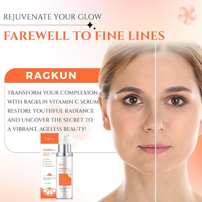 Ragkun 20% Vitamin C Serum, Retinol Serum for Face, Dark Spot Remover for Face, CE Ferulic Acid, Hyaluronic Acid, Hydrate & Plump Skin Care - dailyvitalstore