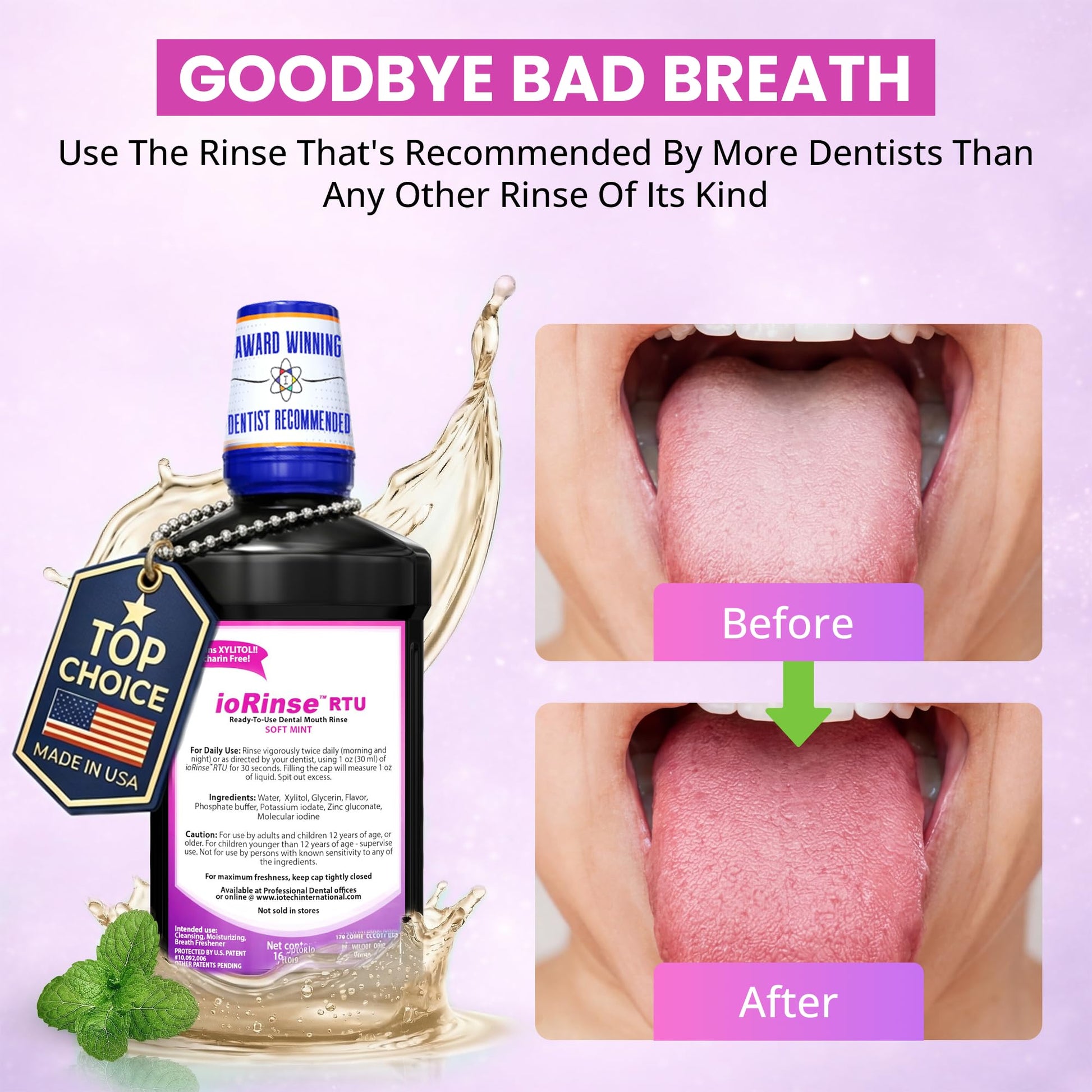 Recommended by 1,000s of Dental Professionals Because it Simply Works Better. Professional Strength ioRinse RTU. Powerful, Long-Lasting, Breath freshening that You Can Trust. Soft Mint 16.9 oz - dailyvitalstore