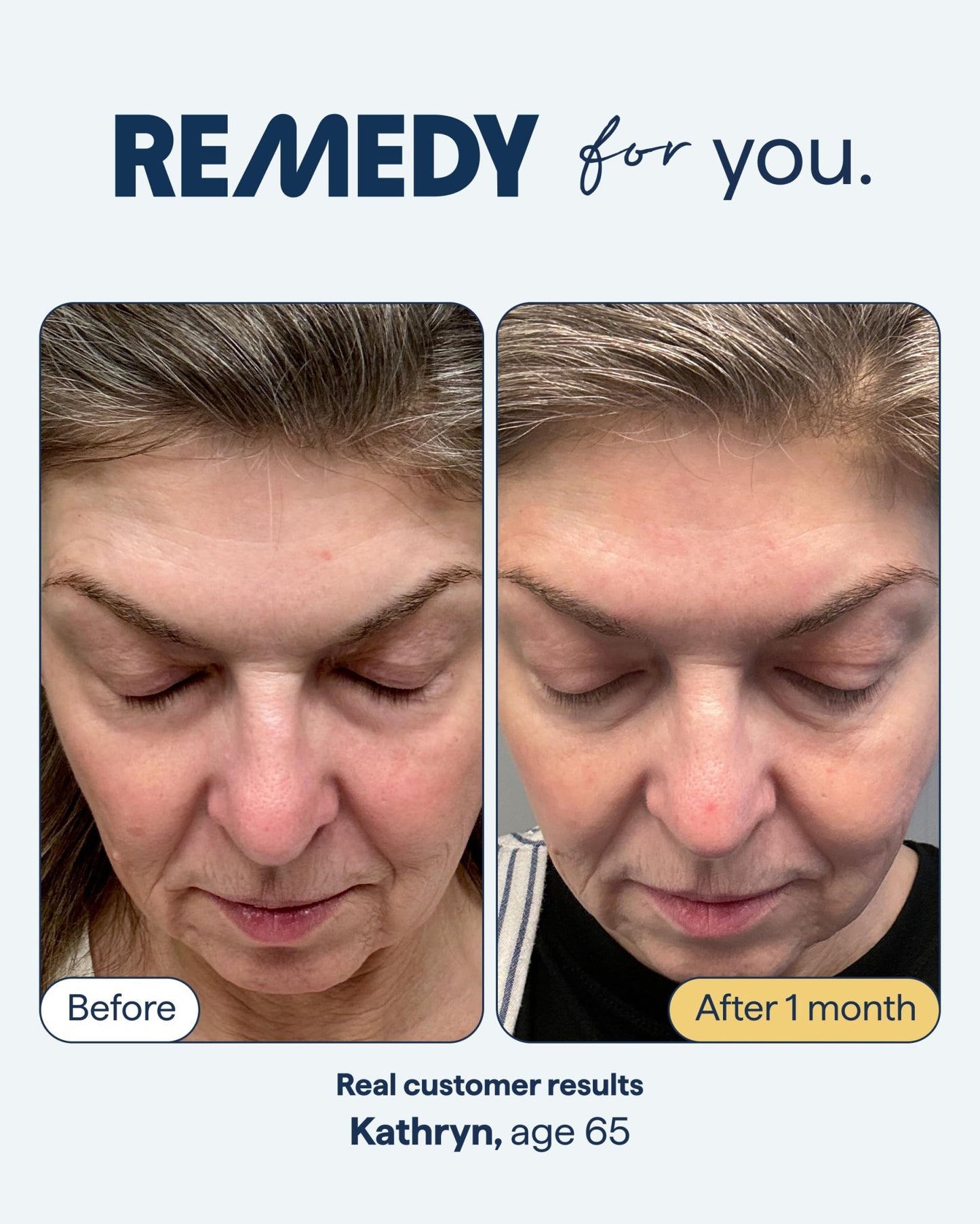 Remedy for Healthy Aging - Retinal, Resveratrol, Glycolic Acid, Argireline, Ferulic Acid, Matrixyl 3000 - Anti-Aging Treatment for Wrinkles, Uneven Texture & Tone - By Dermatologist Dr. Shah - dailyvitalstore