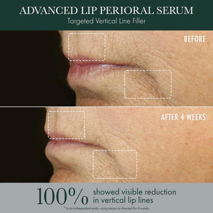 RéVive Advanced Perioral Lip Serum - Anti Aging Perioral Lip Treatment to Reduce Lip Area Lines & Wrinkles -Helps Restore Lip Contour & Visible Fullness(0.5 fl oz) - dailyvitalstore