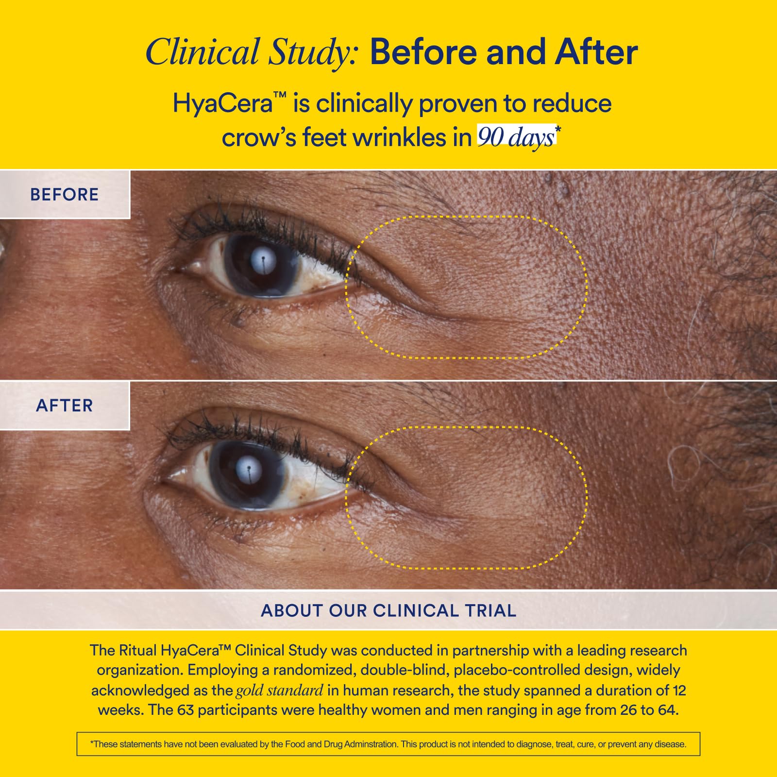 Ritual Hyaluronic Acid Skin Supplement - With Hyabest® and Ceratiq® - HyaCera Clinically Proven to Reduce Wrinkles, Fine Lines & Improve Skin Smoothness - dailyvitalstore