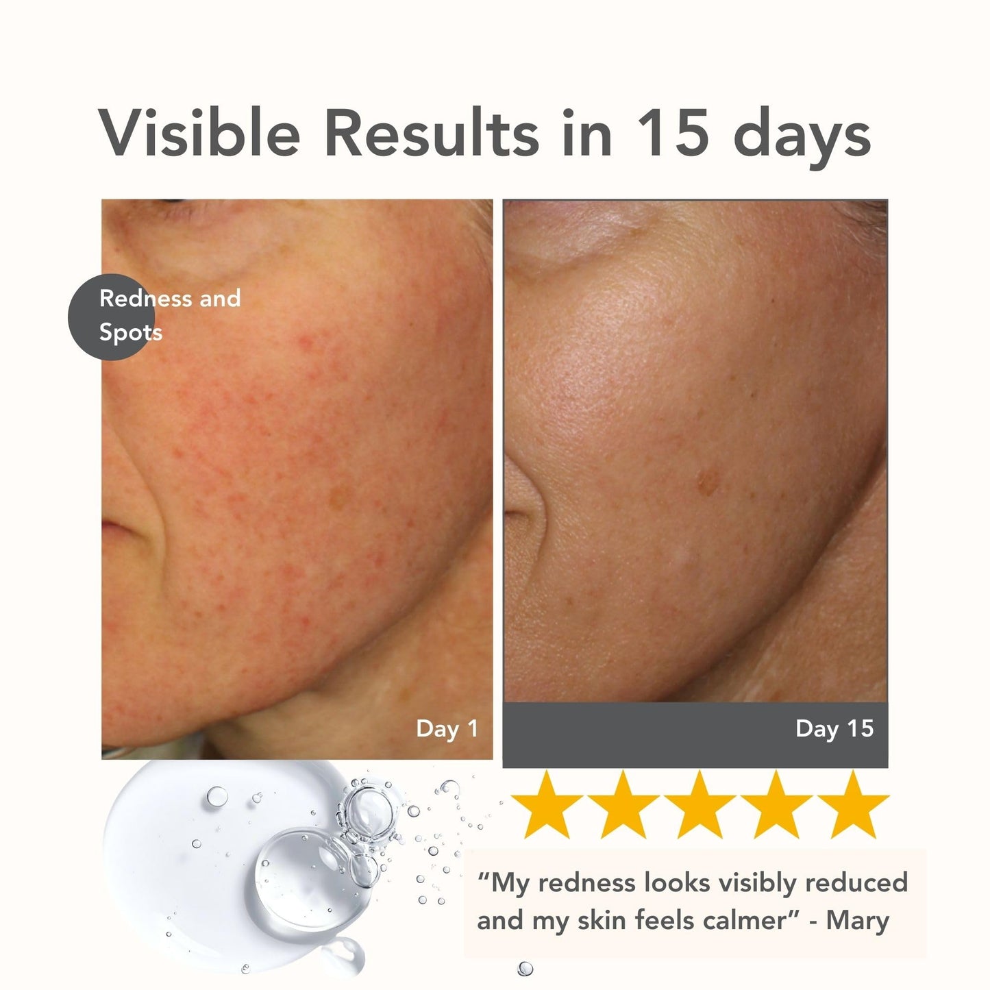 Riversol Rosacea Treatment for Face | Anti-Redness Serum for Sensitive Skin | Calming Redness Relief | Vitamin C & E | Anti-Aging Formula | Fragrance Free - dailyvitalstore