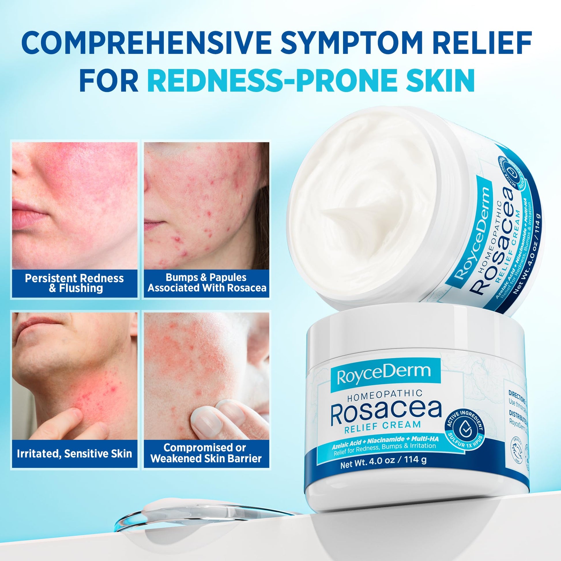 Roycederm Rosacea Treatment for Face with Azelaic Acid – Redness Relief & Corrector – Sensitive Skin Moisturizer for Redness, Bumps & Irritation - dailyvitalstore