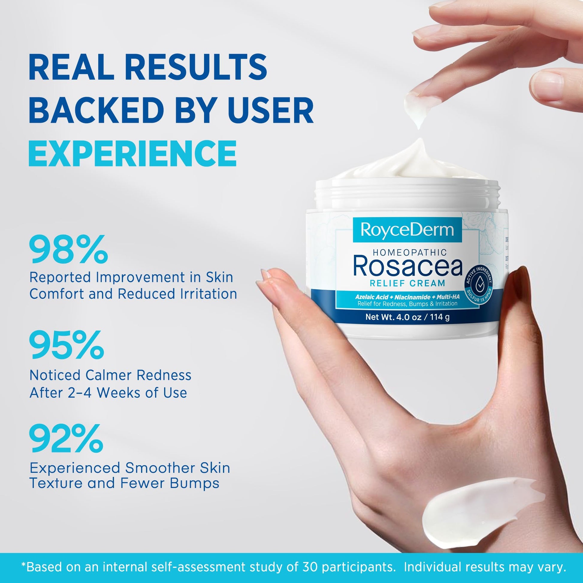 Roycederm Rosacea Treatment for Face with Azelaic Acid – Redness Relief & Corrector – Sensitive Skin Moisturizer for Redness, Bumps & Irritation - dailyvitalstore
