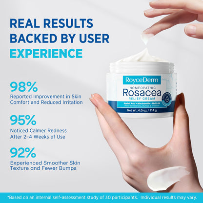 Roycederm Rosacea Treatment for Face with Azelaic Acid – Redness Relief & Corrector – Sensitive Skin Moisturizer for Redness, Bumps & Irritation - dailyvitalstore
