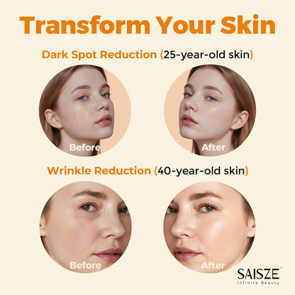 SAISZE Vitamin C Serum for Face, Facial Serum for Dark Spot, Skin Care Gifts for Women, Mothers Day gifts, Anti Aging with Vitamin C, Hyaluronic Acid, 60ml - dailyvitalstore