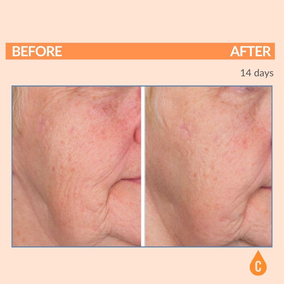 Serious Skincare Vitamin C Serum for Face, Anti-Aging Face Serum with Collagen, Vitamin E, Hydrating Skin Care for Brightening, Improve Appearance of Dark Spots - dailyvitalstore