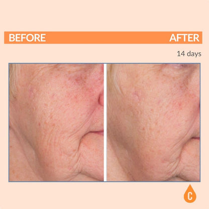 Serious Skincare Vitamin C Serum for Face, Anti-Aging Face Serum with Collagen, Vitamin E, Hydrating Skin Care for Brightening, Improve Appearance of Dark Spots - dailyvitalstore