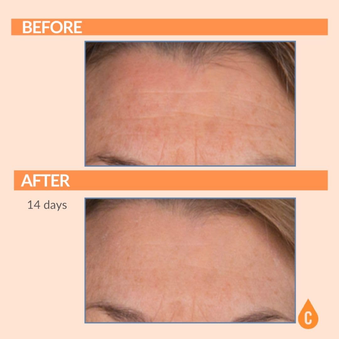 Serious Skincare Vitamin C Serum for Face, Anti-Aging Face Serum with Collagen, Vitamin E, Hydrating Skin Care for Brightening, Improve Appearance of Dark Spots - dailyvitalstore