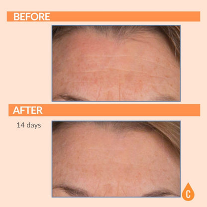 Serious Skincare Vitamin C Serum for Face, Anti-Aging Face Serum with Collagen, Vitamin E, Hydrating Skin Care for Brightening, Improve Appearance of Dark Spots - dailyvitalstore