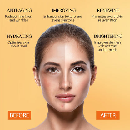 SHVYOG Turmeric Vitamin C Clay Mask with Kaolin Clay for Dull & Blemish-Prone Skin, Deep Cleansing Facial Mask, Face Masks Skincare for Controlling Oil - dailyvitalstore