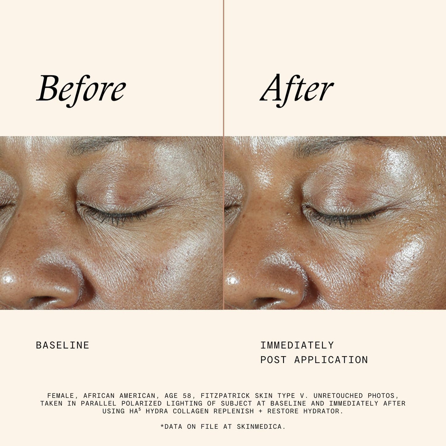 SkinMedica HA5 Hydra Collagen Hydrator with Vegan Collagen (NEW PACKAGING), Age-Defying Skincare for Women with Hyaluronic Acid - dailyvitalstore