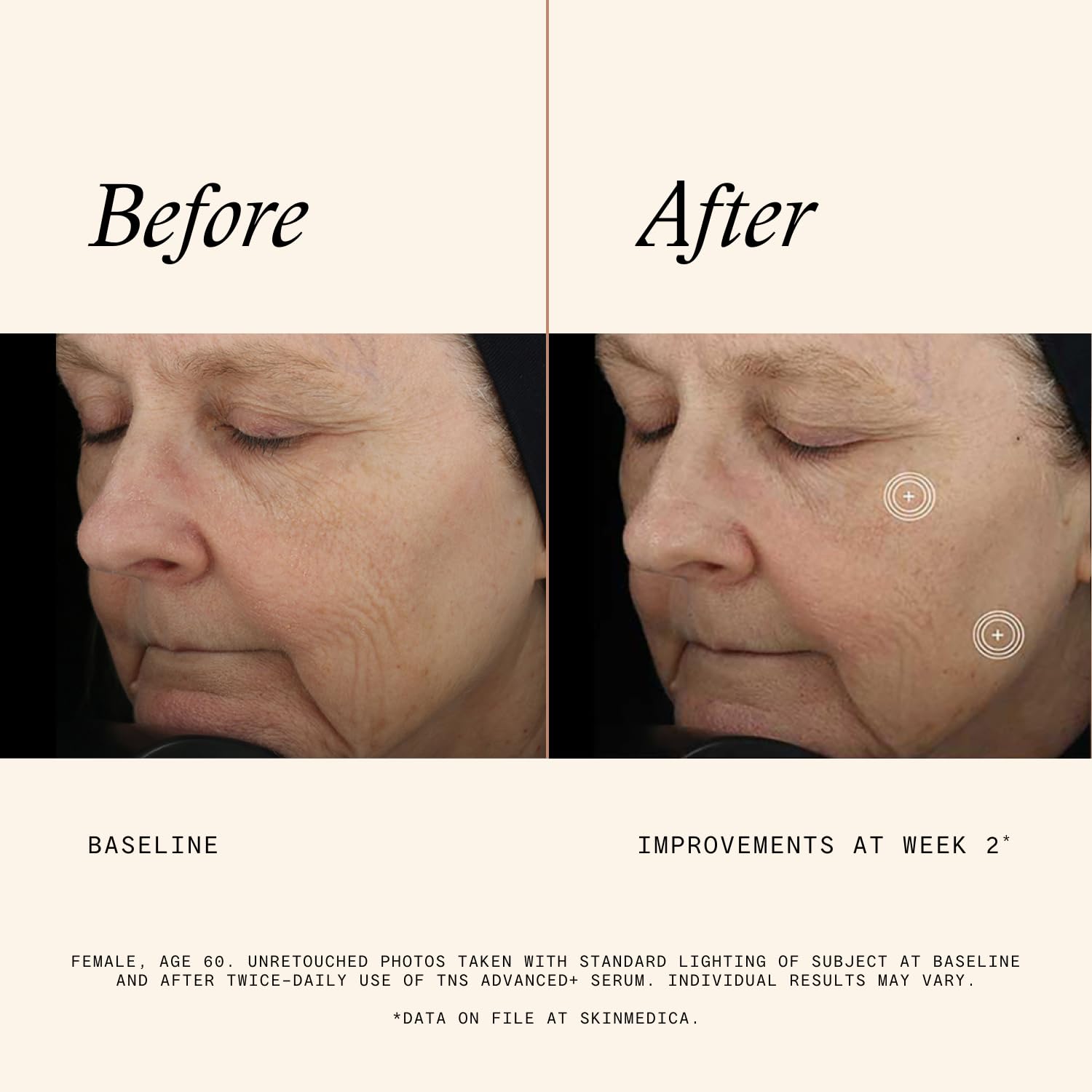 SkinMedica TNS Advanced+ Face Serum - Multi Peptide Serum to Help Improve the Appearance of Wrinkles, Fine Lines, Skin Tone & Texture (1 oz) - dailyvitalstore