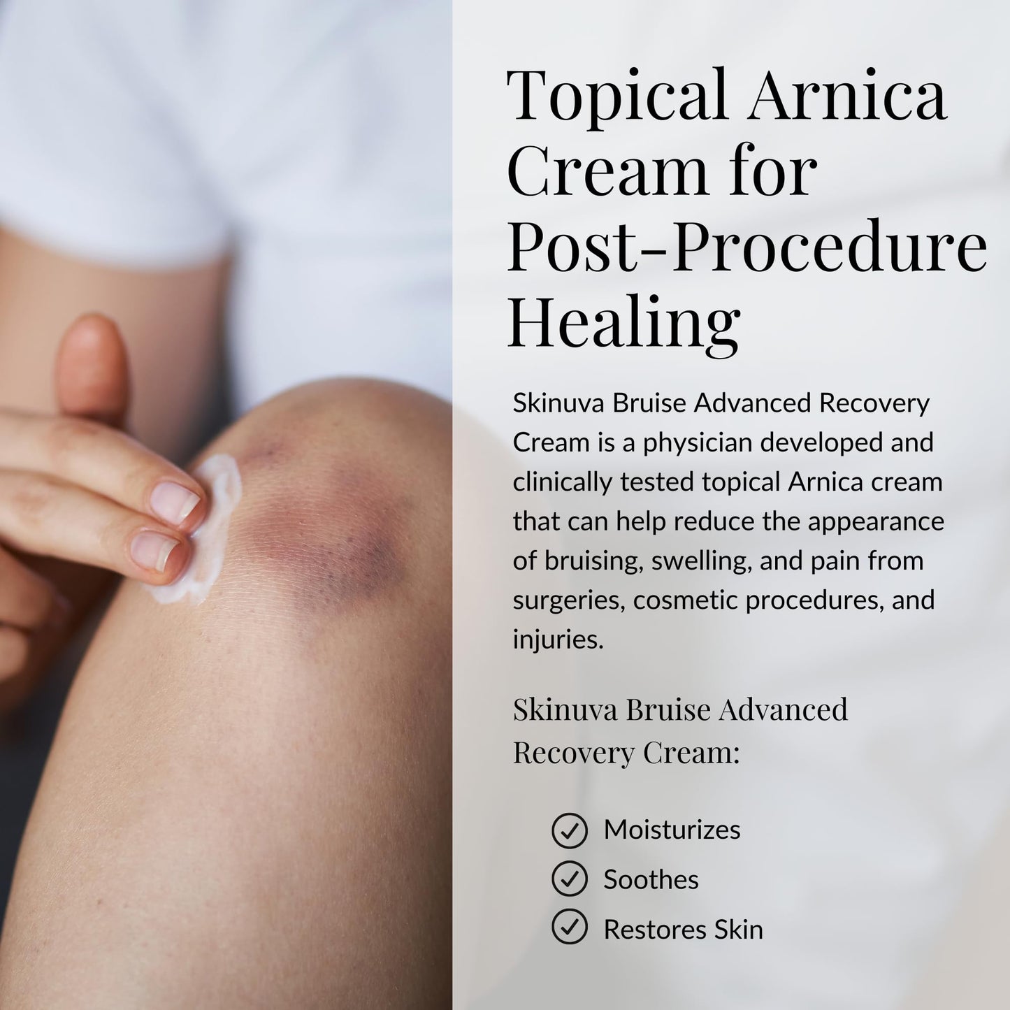 Skinuva® Bruise Advanced Recovery Cream - Topical Bruise Cream Formulated with Growth Factors, Arnica & Vitamin K (1 oz) - dailyvitalstore