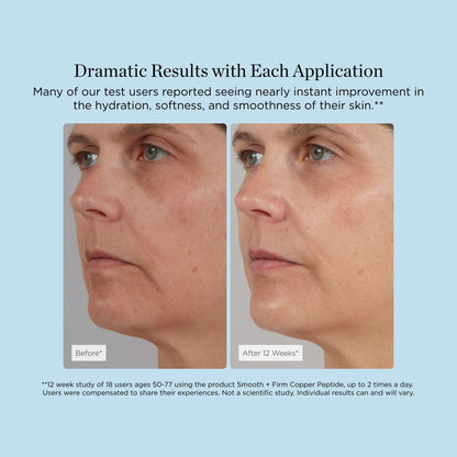 Smooth + Firm Copper Peptide Concentrate Serum for Aging Skin, Plumping Niacinamide for Tightening & Brightening, Helps Improve Elasticity, Hyperpigmentation & Dark Spots, Water Based, 1.18 Fl Oz - dailyvitalstore