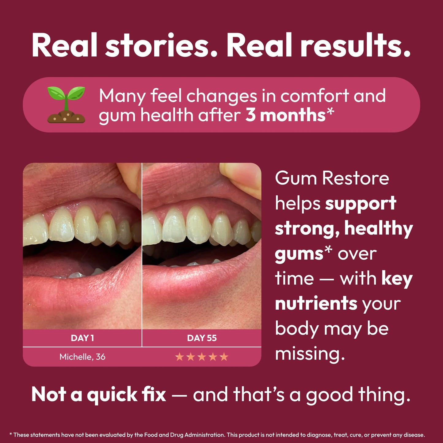 Strong Jaw Gum Restore - Gum Repair for Receding Gums | Teeth Magnesium Supplements, Oral Care, Remineralizing Dental Health Vitamins for Adults | 1 Month Supply, 180 Capsules, Made in USA - dailyvitalstore
