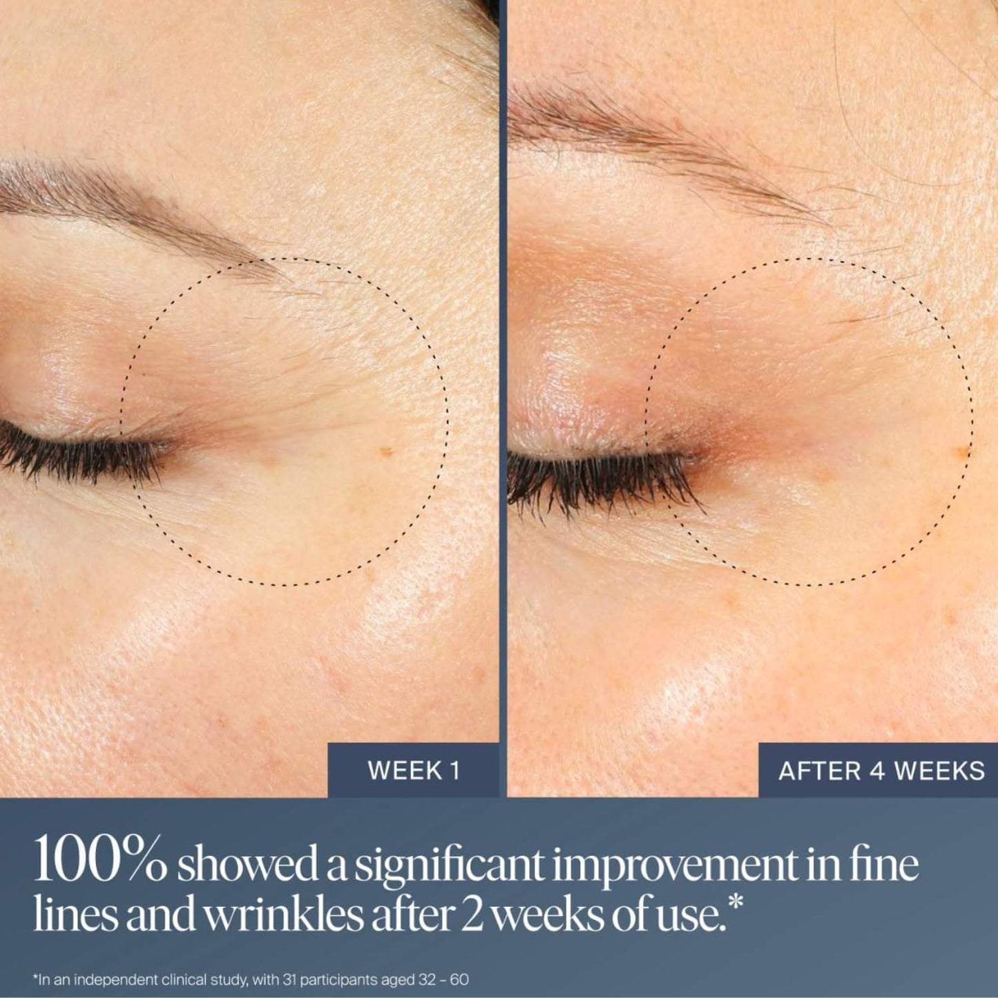Summer Fridays Jet Lag Overnight Eye Serum - Nourishing Undereye Treatment for Dark Circles - Helps to Hydrate, Smooth, Firm & Depuff - Enriched with Glycerin to Lock in Moisture (0.5 Fl Oz) - dailyvitalstore