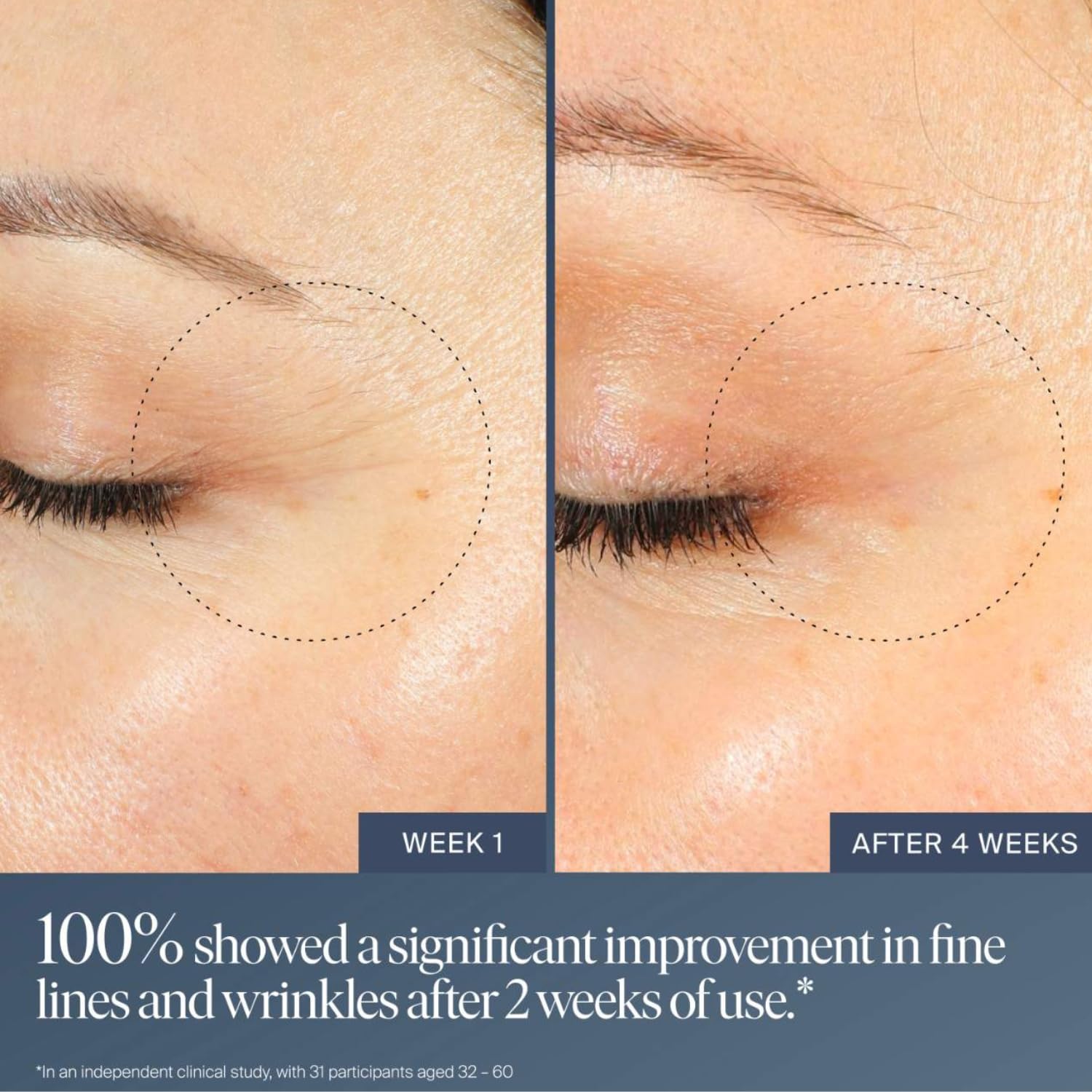 Summer Fridays Jet Lag Overnight Eye Serum - Nourishing Undereye Treatment for Dark Circles - Helps to Hydrate, Smooth, Firm & Depuff - Enriched with Glycerin to Lock in Moisture (0.5 Fl Oz) - dailyvitalstore