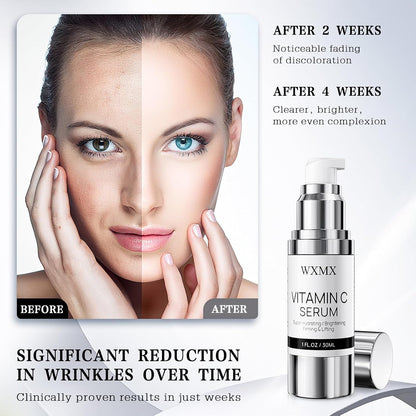 Super Vitamin C Serum for Face: All-in-One Hydrating Anti-Aging Formula by Vitamin C, Hyaluronic Acid, Caffeine-Firming, Lifting, Targets Dark Spots, - dailyvitalstore