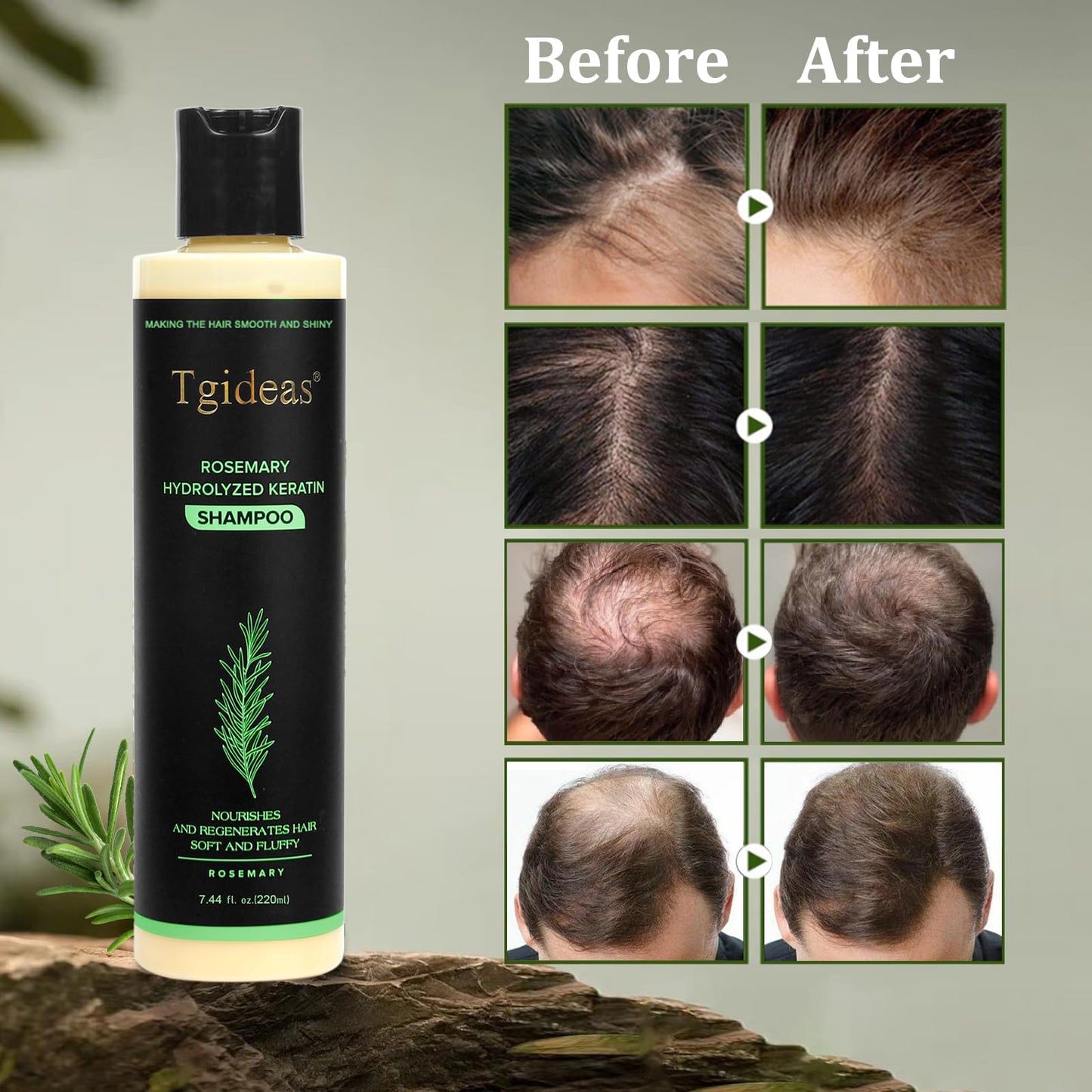 Tgideas Organic Rosemary Hair Growth Shampoo for Women and Men-Natural Thickening & Strengthening Shampoo with Hydrolyzed Keratin - dailyvitalstore