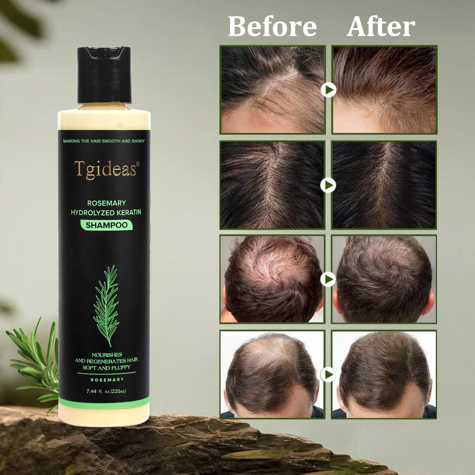 Tgideas Organic Rosemary Hair Growth Shampoo for Women and Men-Natural Thickening & Strengthening Shampoo with Hydrolyzed Keratin - dailyvitalstore