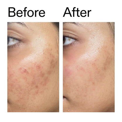 The INKEY List Ectoin Hydro-Barrier Serum, Advanced Dual-Action Serum, Boosts Hydration, Builds Stronger Skin Barrier, Lightweight Texture - dailyvitalstore