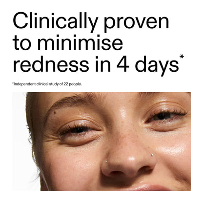 The INKEY List SuperSolutions Azelaic Acid 10% Serum, Fast-Absorbing Formula Helps Reduce Appearance of Redness and Soothes Skin, - dailyvitalstore