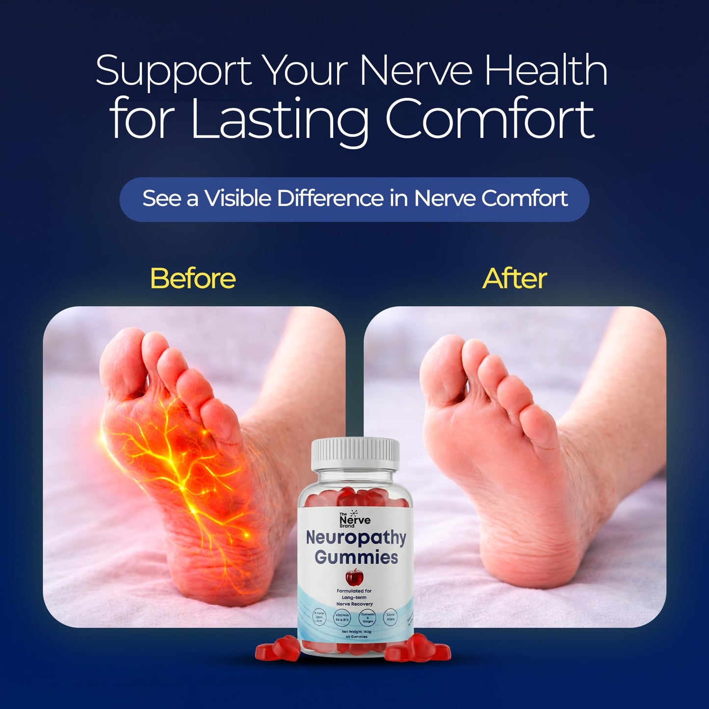 The Nerve Brand Neuropathy Support Gummies, 600 mg R Alpha Lipoic Acid Gummies with B1 B6 B12 and Lion’s Mane, Sugar Free Daily Nerve Health Supplement, 30 Day Supply - dailyvitalstore
