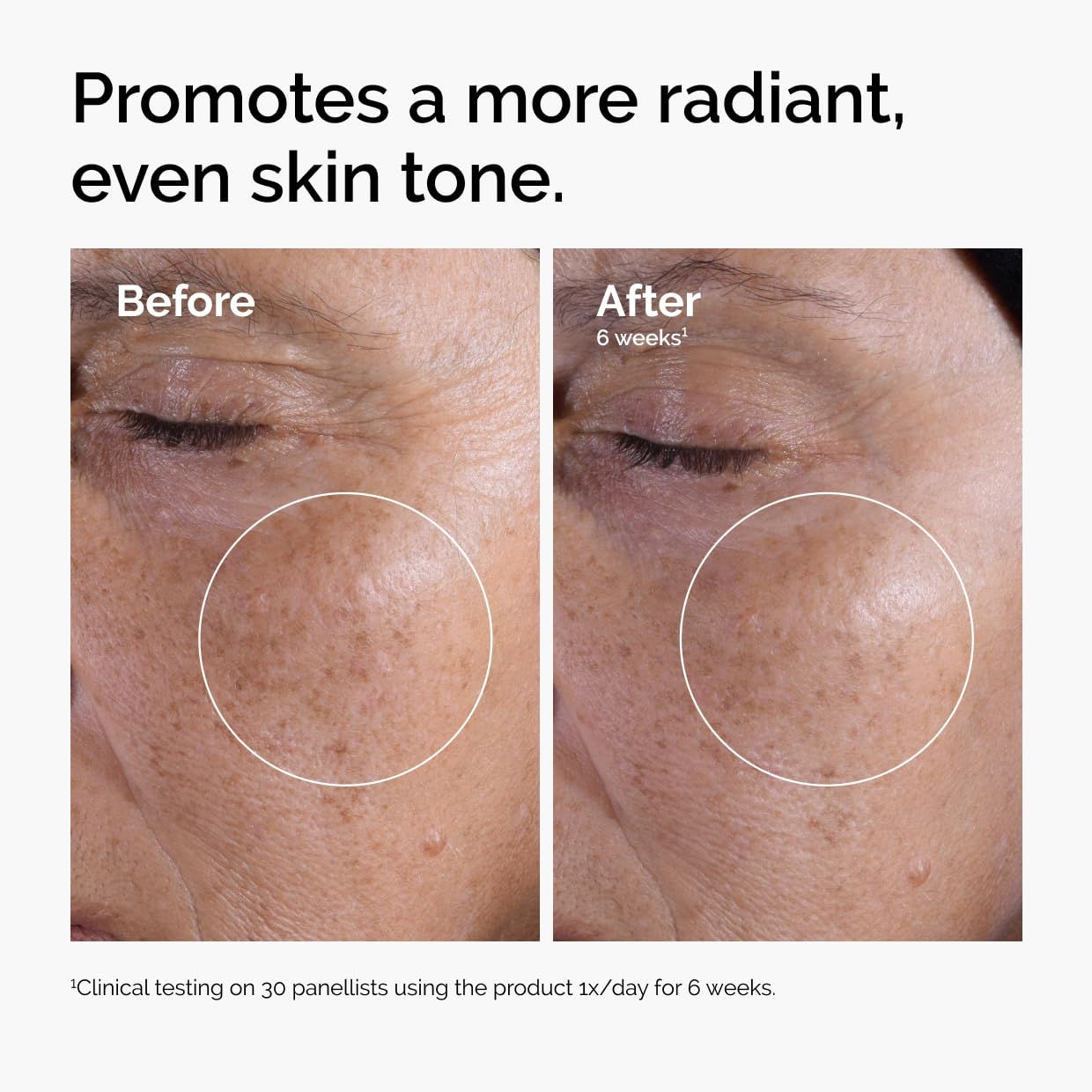 The Ordinary Glycolic Acid 7% Exfoliating Toner, Brightening and Smoothing Daily Toner for More Even-Looking Skin Tone, 3.4 Fl Oz (Pack of 2) - dailyvitalstore