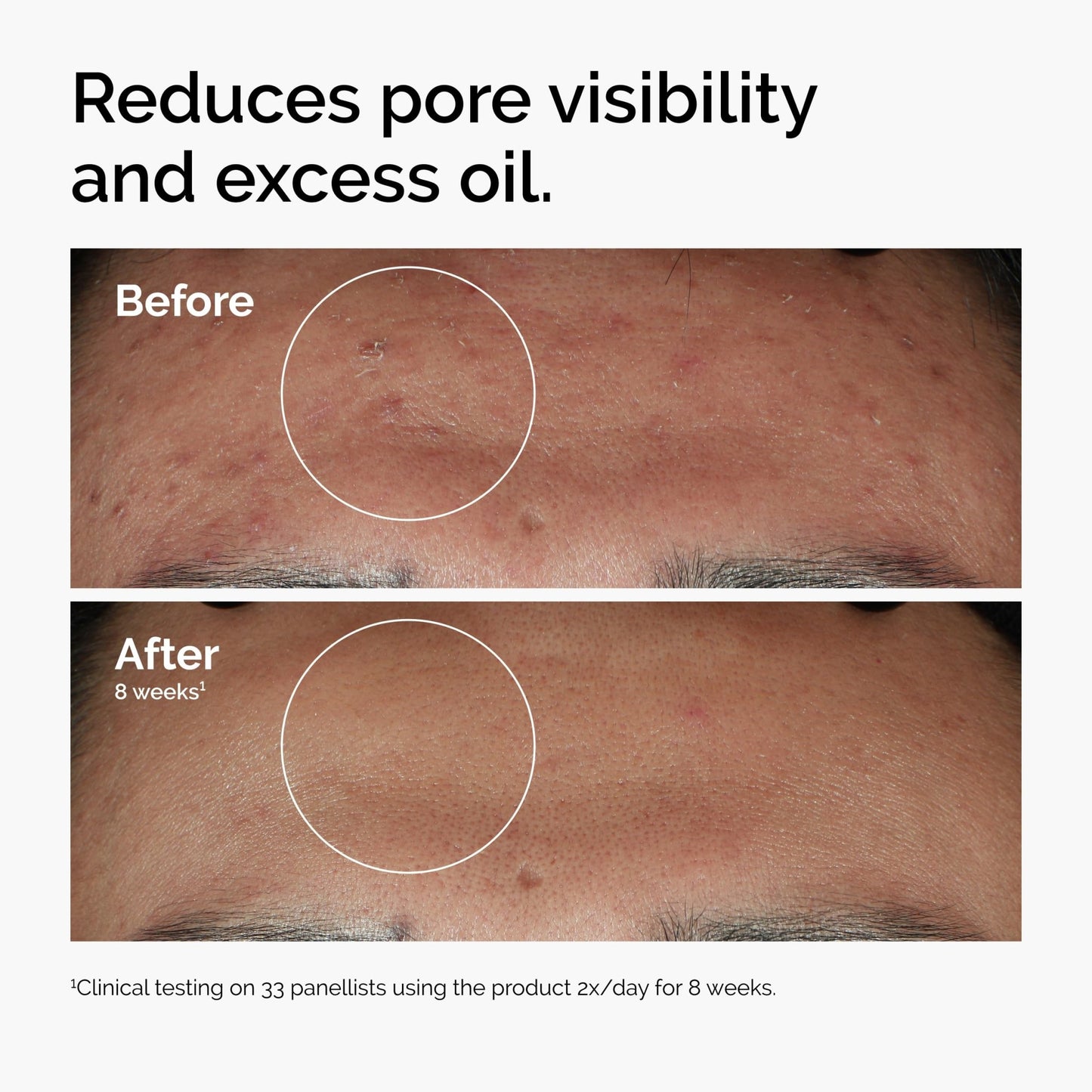 The Ordinary Serum Favorites Set – Hyaluronic Acid 2% + B5, Niacinamide 10% + Zinc 1%, Caffeine Solution 5% + EGCG Eye Serum, Serums for Hydrating, - dailyvitalstore