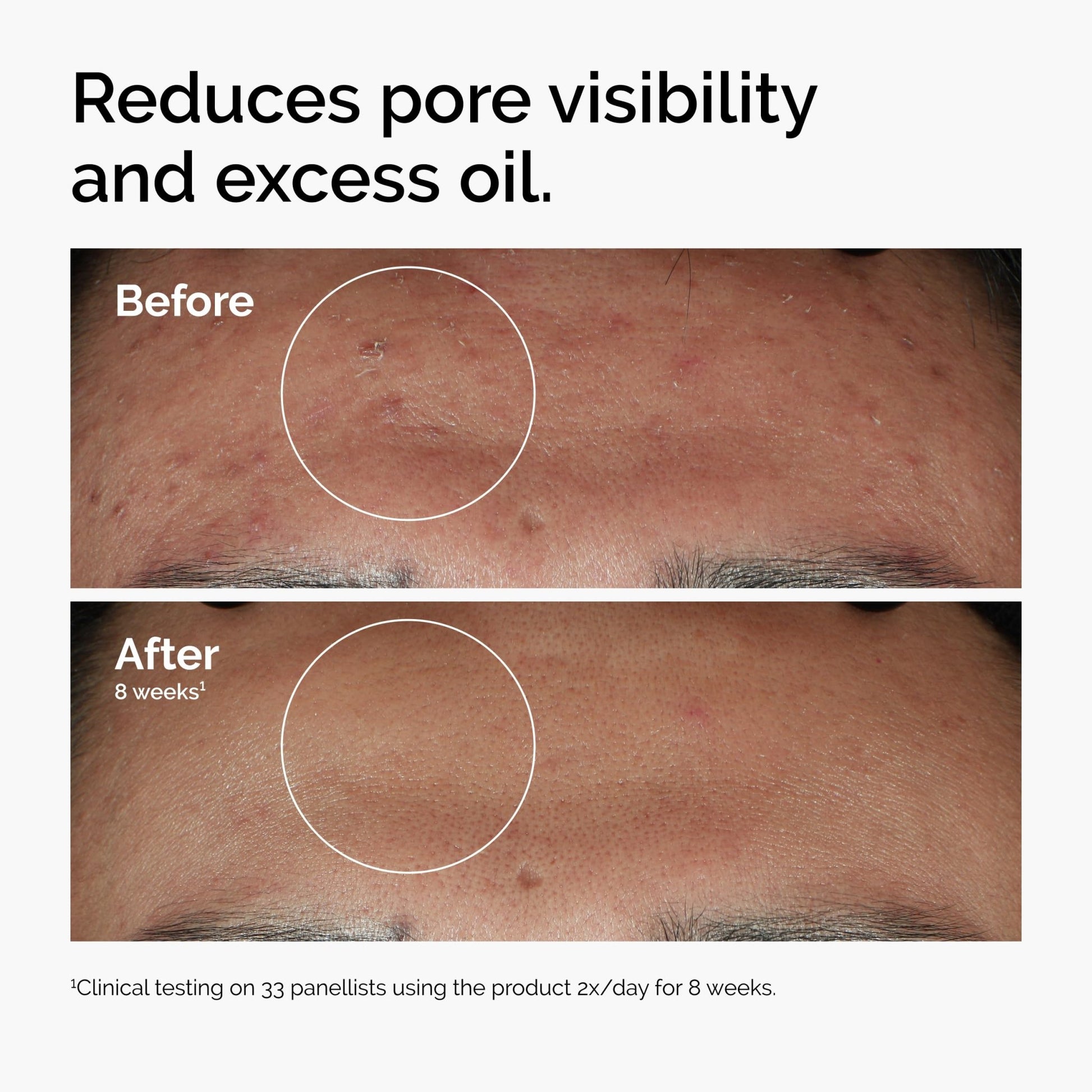 The Ordinary Serum Favorites Set – Hyaluronic Acid 2% + B5, Niacinamide 10% + Zinc 1%, Caffeine Solution 5% + EGCG Eye Serum, Serums for Hydrating, - dailyvitalstore