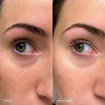 Topicals Faded Brightening Under Eye Masks | Patches to Depuff, Hydrate, Brighten and Cool | Reduce Dark Circles and Fine Lines | Contains Kojic Acid, Caffeine and Niacinamide (Set of 6) - dailyvitalstore