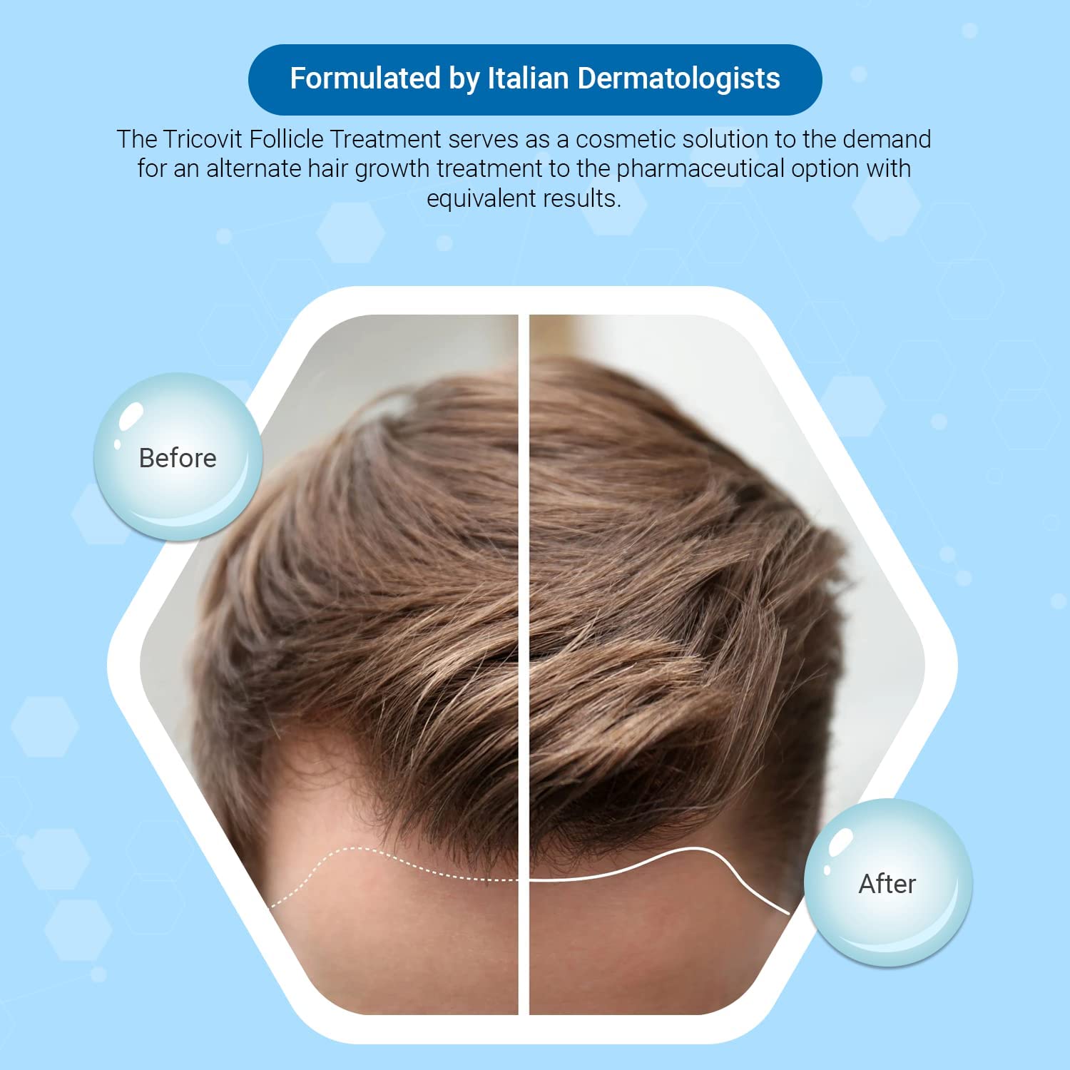 Tricovit Hair Growth Supplement - Nail & Hair Health Vitamins with Amino Acids, Minerals & Antioxidants - Dermatologist-Formulated & Gluten-Free Vitamins and Supplements for Women & Men (60 tablets) - dailyvitalstore