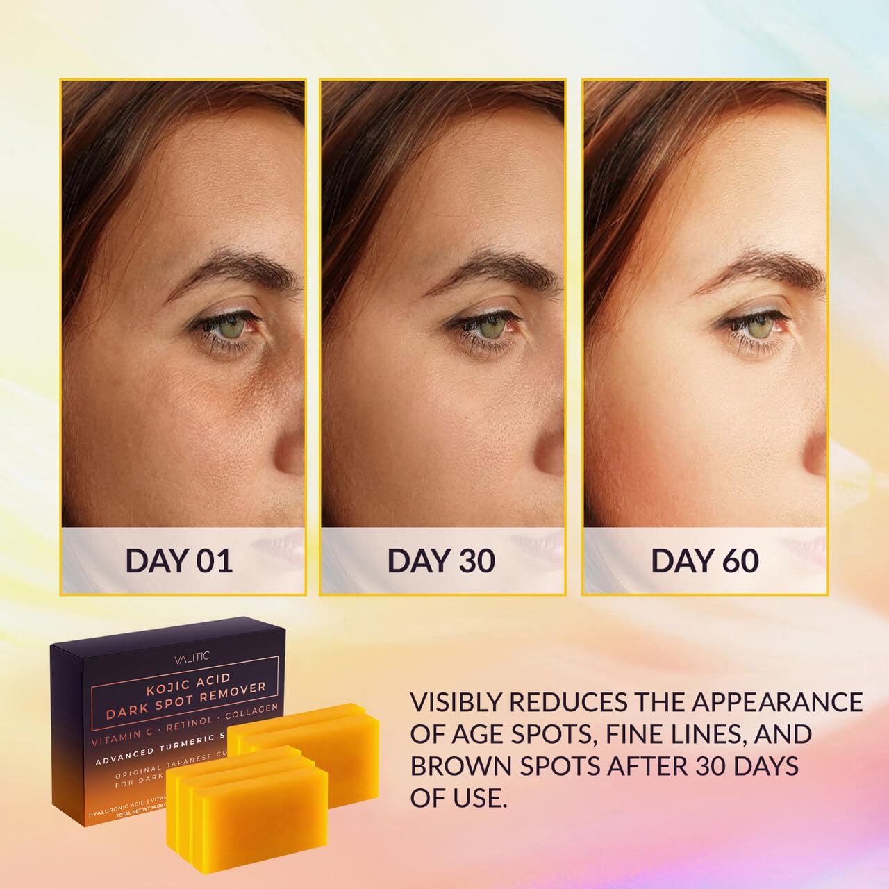 VALITIC Kojic Acid Dark Spot Remover Soap Bars with Vitamin C, Retinol, Collagen, Turmeric - Original Japanese Complex Infused with Hyaluronic Acid, - dailyvitalstore