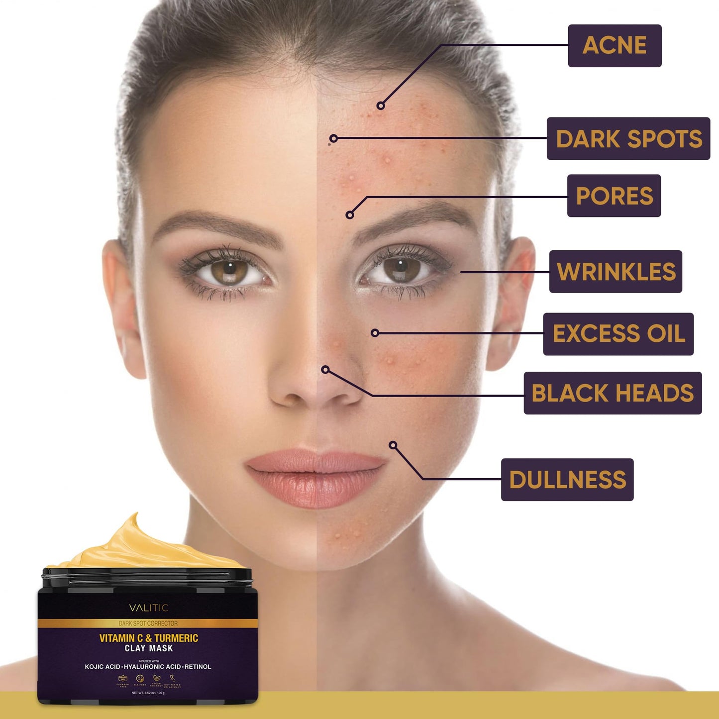 VALITIC Vitamin C & Turmeric Clay Mask - Dark Spot Corrector with Kojic Acid, Hyaluronic Acid & Retinol - Skin Care Routine for Minimizing Pores - dailyvitalstore