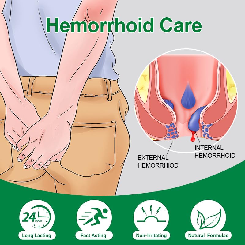 vamy Hemorrhoid Ointment (2 x 20g Tubes), 40g - Maximum Strength Formula for Hemorrhoidal Fast Relief, Soothes Itching, Burning & Discomfort - dailyvitalstore