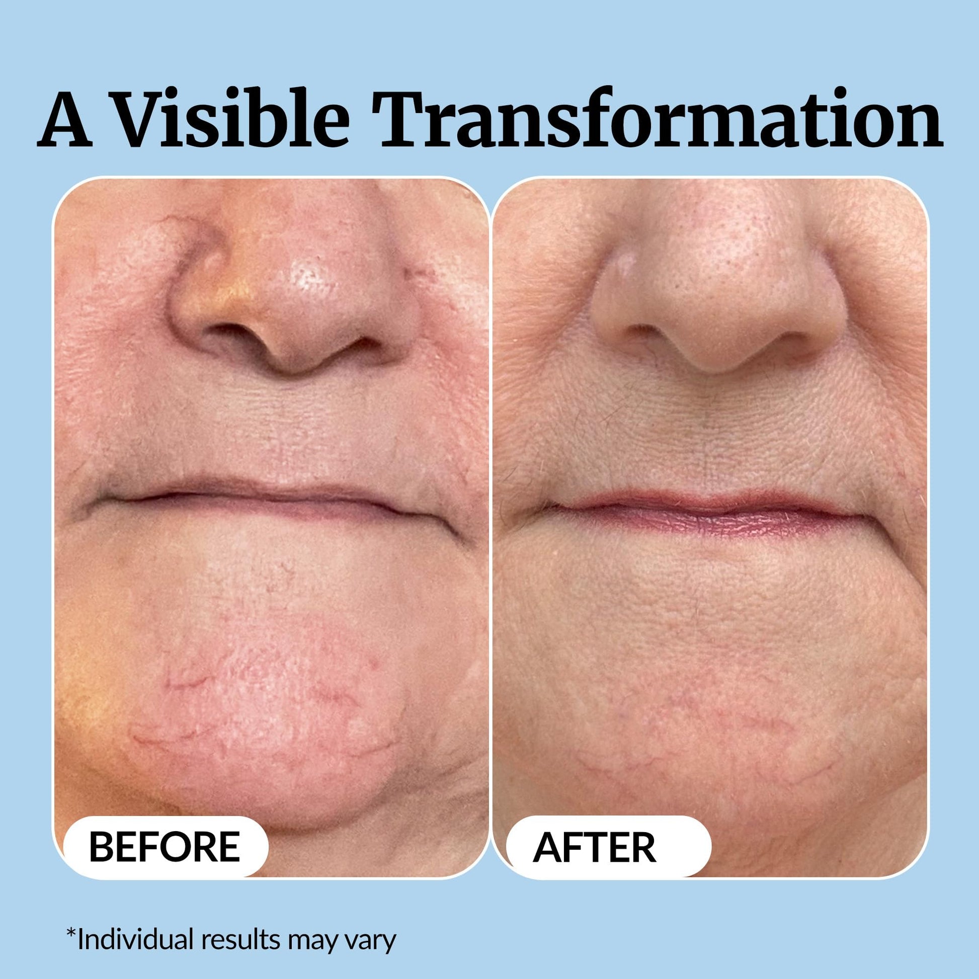 Vibriance Super C Serum for Mature Skin - All-in-One Vitamin Formula Hydrates, Firms, Lifts, Smooths, Targets Age Spots, Wrinkles, 1 fl oz - Pack of 3 - dailyvitalstore