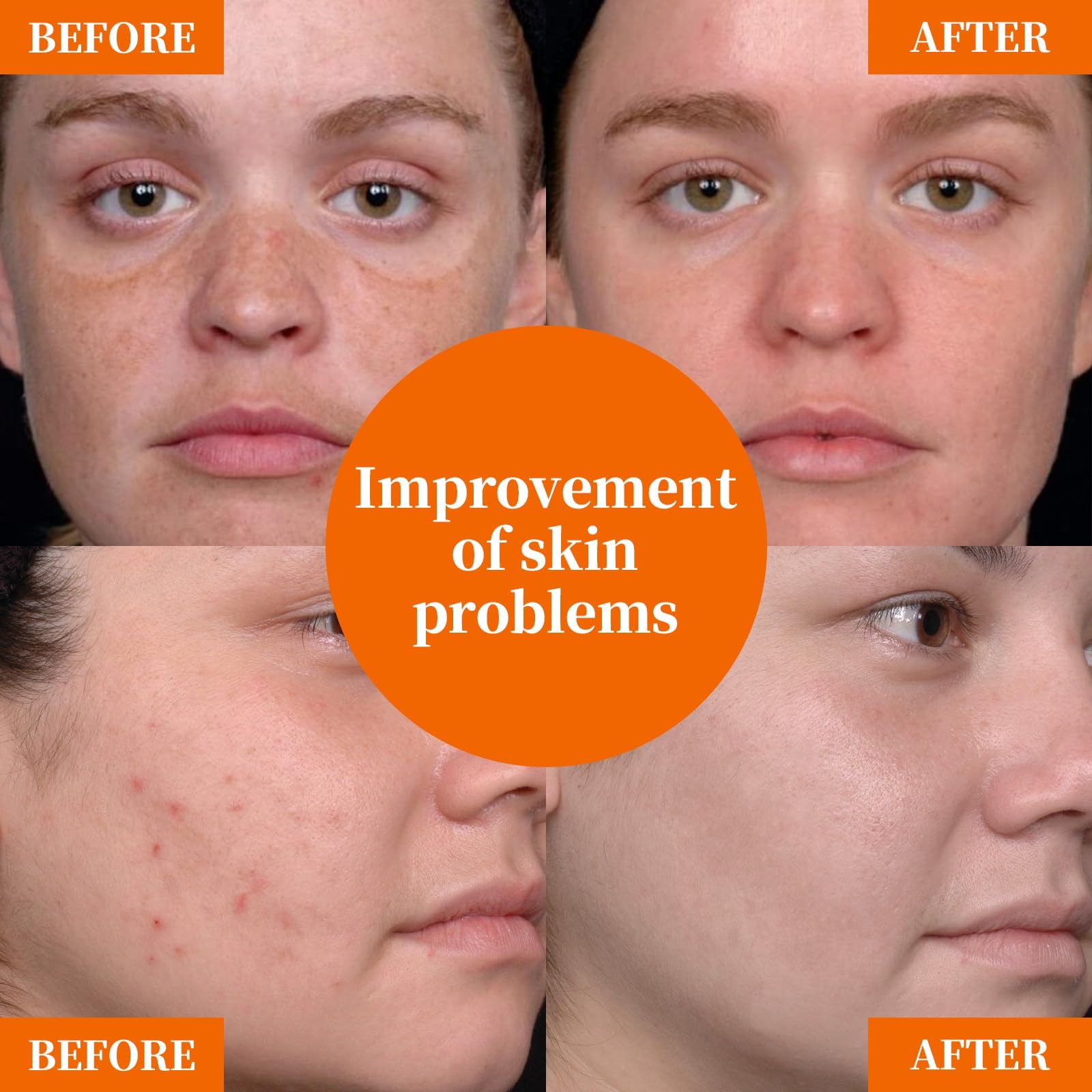 Vitamin C Face Serum with Hyaluronic Acid Niacinamide and Aloe Vera For All Skin Types Anti-Aging & Hydrating Serum Helps Reduce - dailyvitalstore