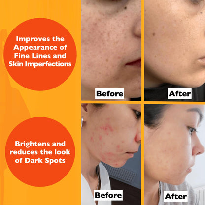 Vitamin C Serum For Face – Anti Aging Face Serum with Vitamin C, Hyaluronic Acid, Vitamin E. Brightening Formula. Improve Appearance of Dark Spots, - dailyvitalstore