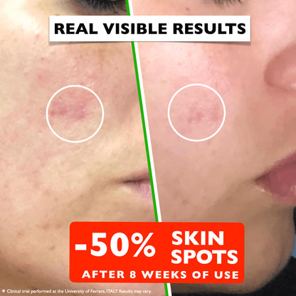 Vitamin C Serum For Face – Anti Aging Face Serum with Vitamin C, Hyaluronic Acid, Vitamin E. Brightening Formula. Improve Appearance of Dark Spots, - dailyvitalstore