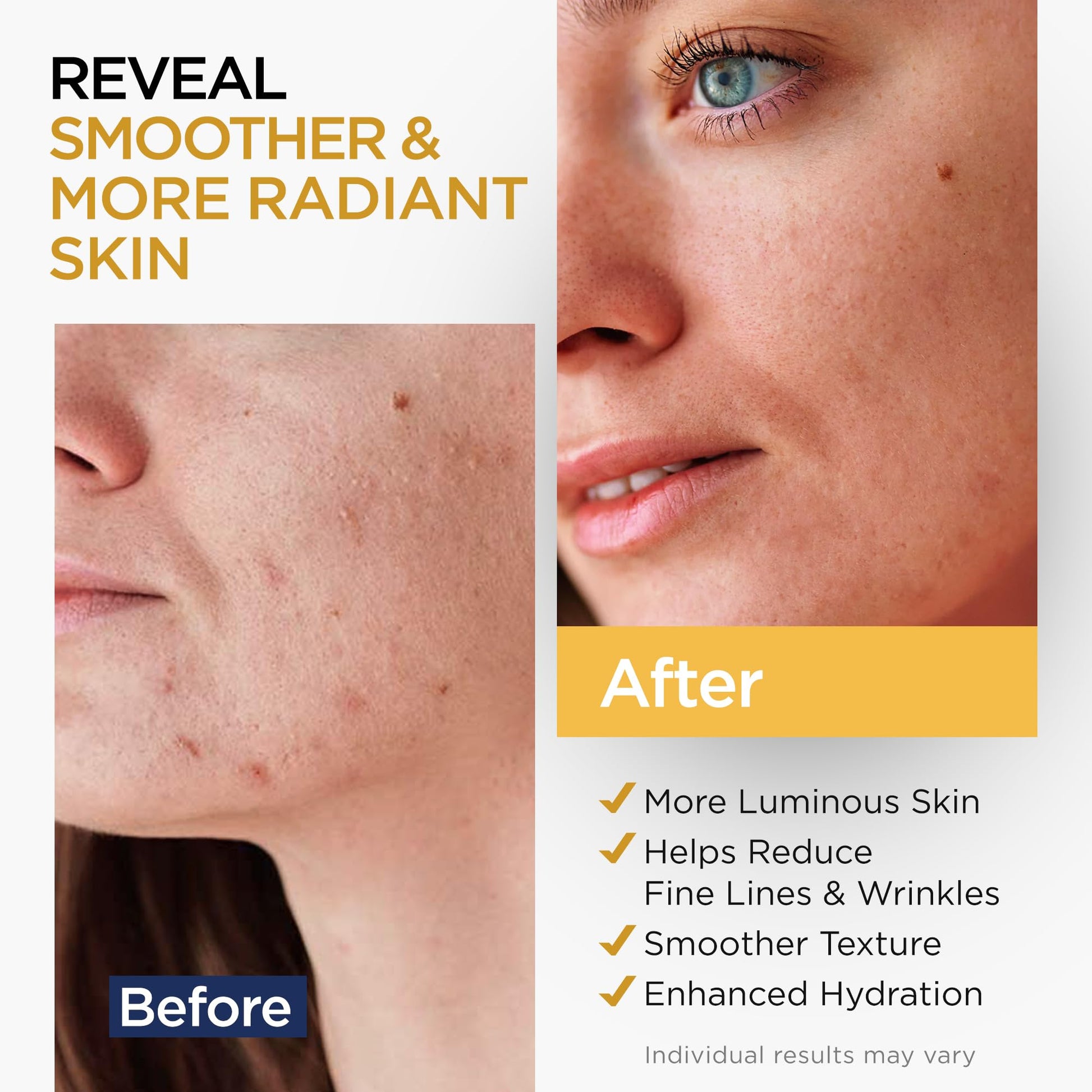 Vitamin C Serum for Face with Stem Cells Hyaluronic Acid Aloe Vera Vitamin E Anti-Aging Face Serum Supports Skin Health & Even Tone - dailyvitalstore